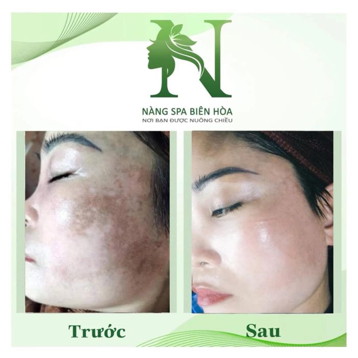 Quy trình điều trị chuyên nghiệp tại Nàng Spa Biên Hòa
