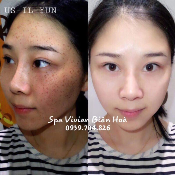 Không gian trị liệu cao cấp tại Vivian Spa