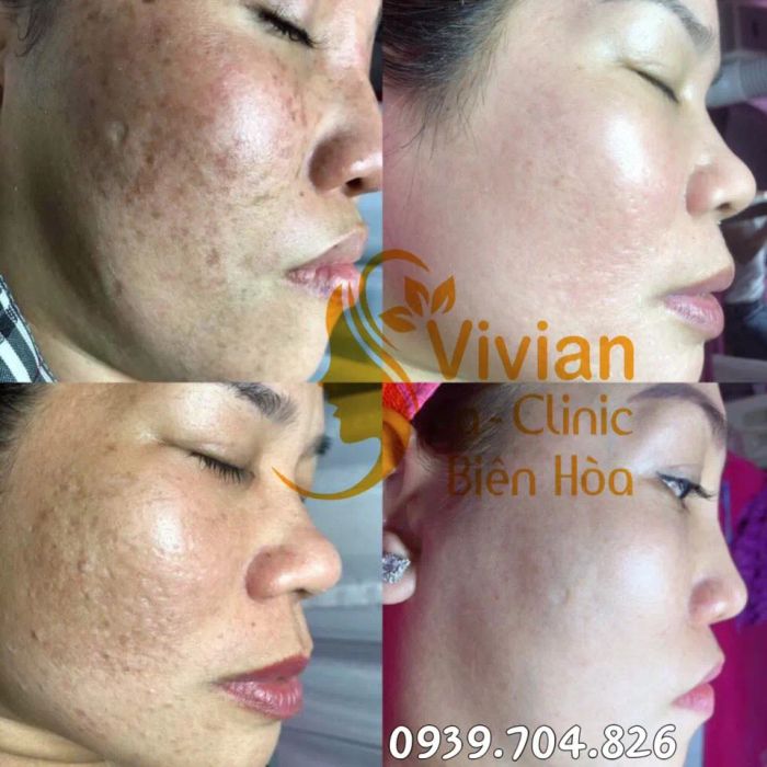 Hình ảnh liệu trình chăm sóc da chuyên sâu tại Vivian Spa