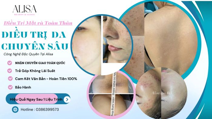 Không gian trị liệu cao cấp tại ALISA Spa Biên Hòa