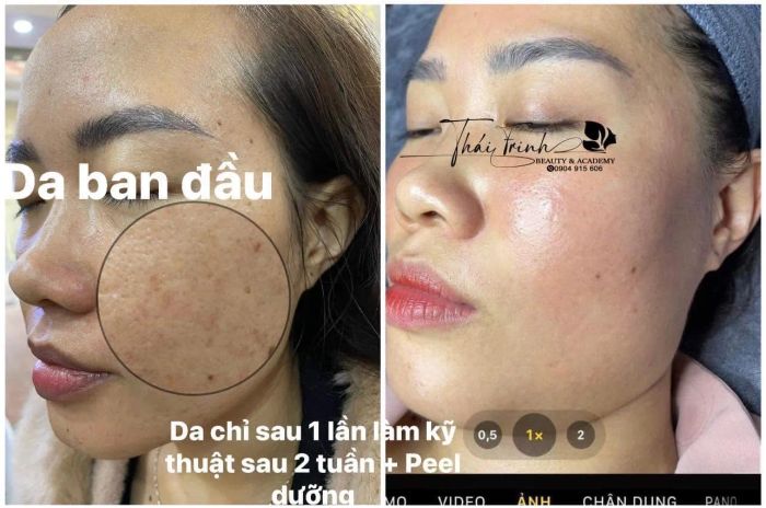 Hình ảnh liệu trình chăm sóc da chuyên sâu tại Thái Trinh Spa