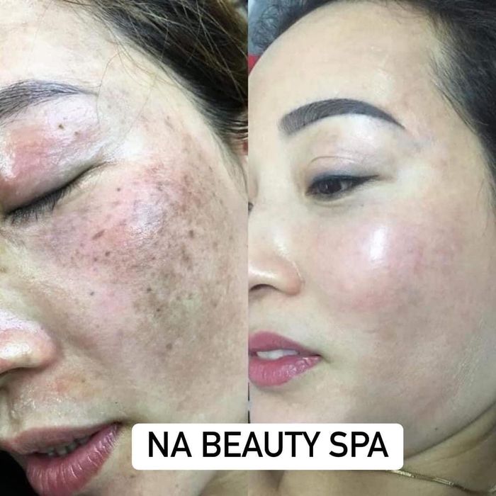 Na Beauty Spa - Hệ thống máy móc hiện đại chuẩn y khoa