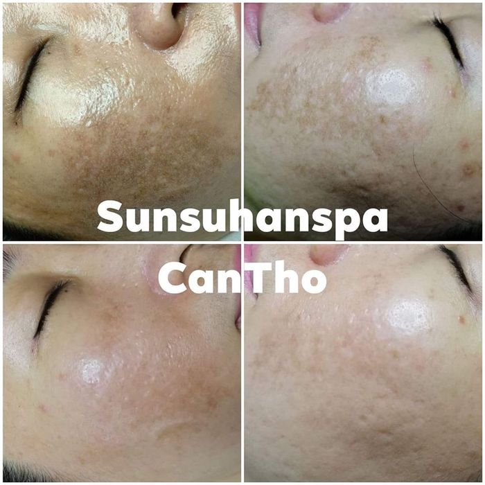 SUNSUHAN Spa Cần Thơ - Phòng trị liệu hiện đại với công nghệ cao