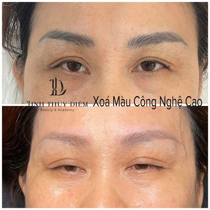 Hình ảnh Thẩm Mỹ Viện LINH THUÝ DIỄM (2)