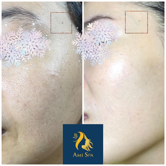 Ami Spa Cần Thơ - Phòng trị liệu công nghệ cao