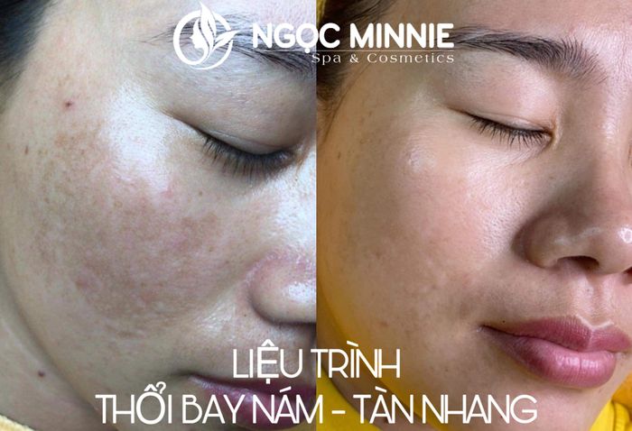 Ngọc Minnie Spa - Không gian trị liệu sang trọng và hiện đại