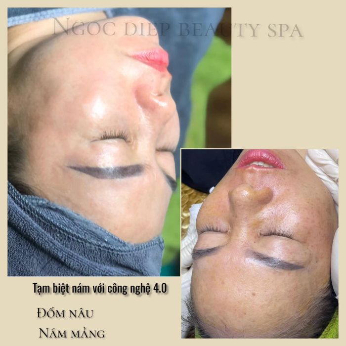 Hình ảnh quy trình trị liệu chuyên nghiệp tại Ngọc Điệp Spa