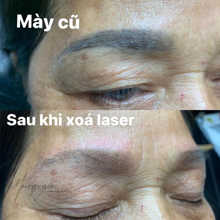 Hình ảnh thực tế về quy trình làm đẹp chuẩn y khoa tại Mai Nguyen Brows