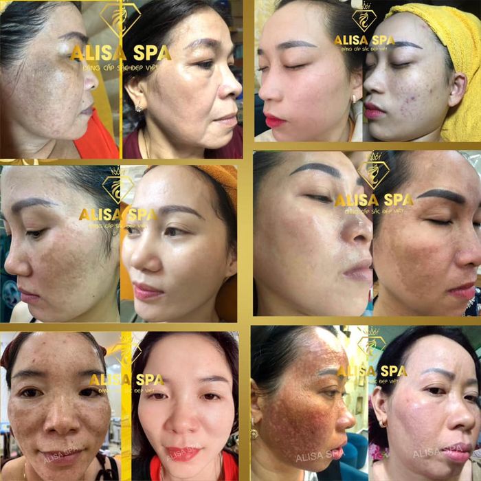 Hình ảnh Thẩm Mỹ Viện ALISA - Không gian trị liệu cao cấp