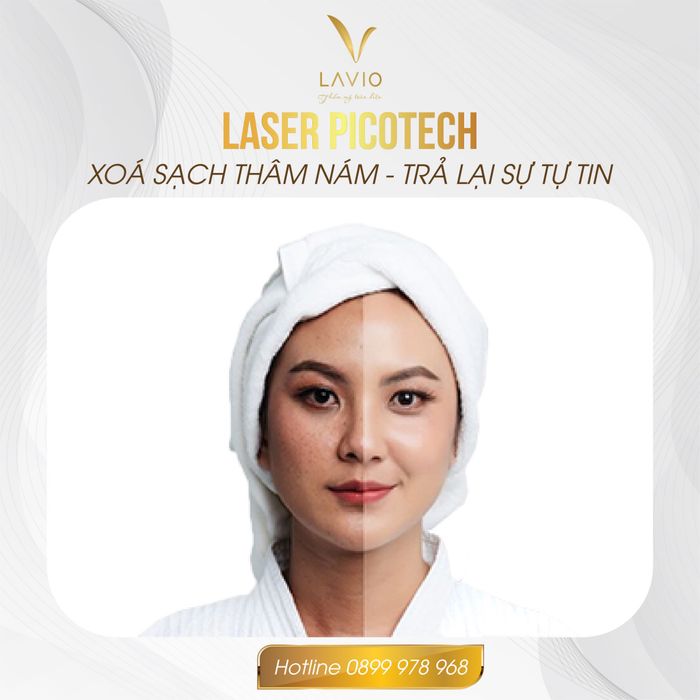 LAVIO Spa & Clinic Cần Thơ - Không gian thư giãn đẳng cấp