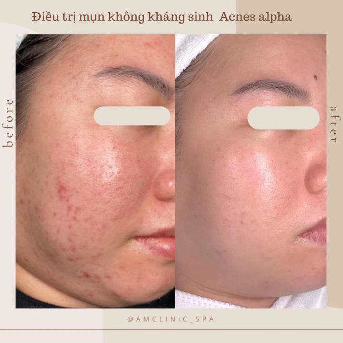 Hình ảnh không gian sang trọng tại Ẩm Spa & Clinic