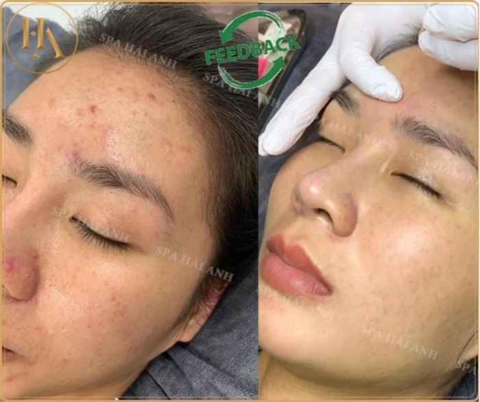 Hình ảnh không gian điều trị tại Spa Hải Anh