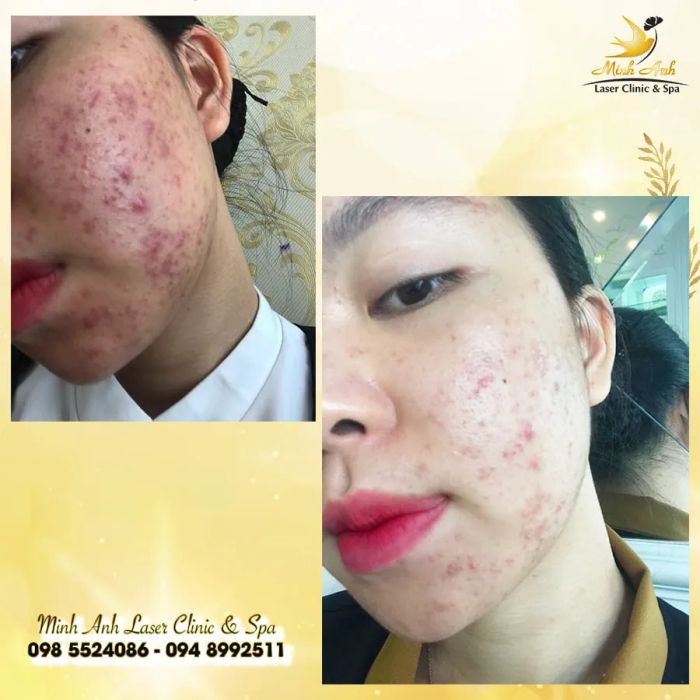 Hình ảnh Minh Anh Laser Clinic & Spa