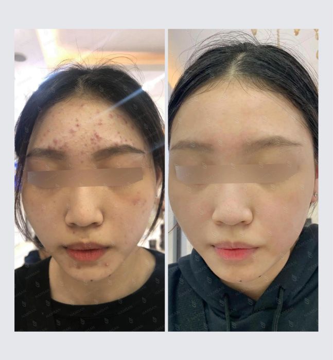 Hình ảnh quy trình điều trị chuyên nghiệp