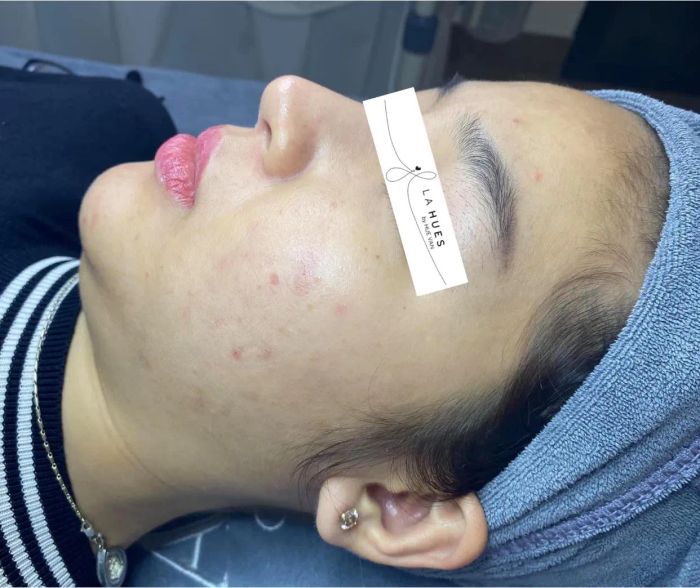 Hình ảnh không gian điều trị tại La Hues Spa & Clinic