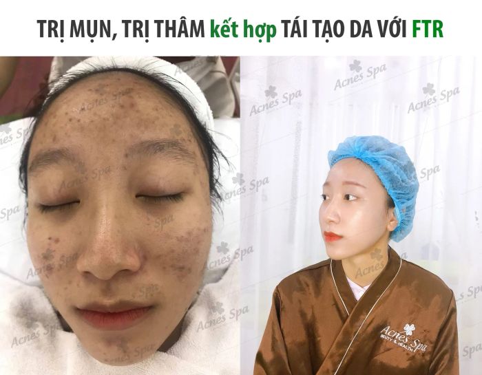 Hình ảnh không gian sang trọng tại Acnes Spa