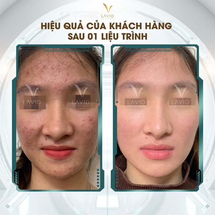 Không gian trị liệu cao cấp tại LAVIO Spa & Clinic