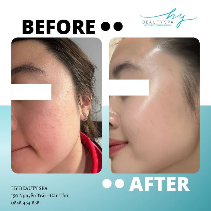 Không gian sang trọng tại Hy Beauty Spa