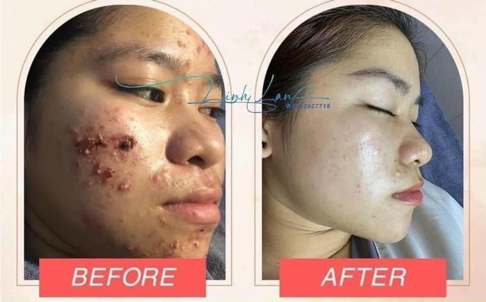 Không gian trị liệu ấm cúng tại Spa LinhLan
