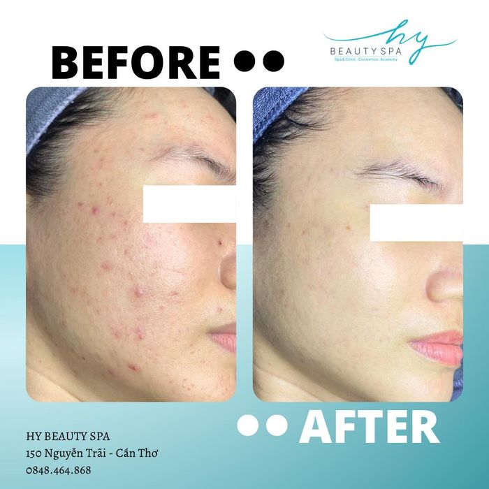 Không gian sang trọng và hiện đại tại Hy Beauty Spa