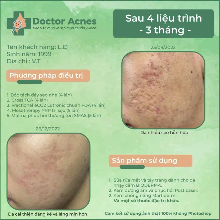 Hình ảnh liệu trình điều trị tại Phòng khám Da liễu Doctor Acnes