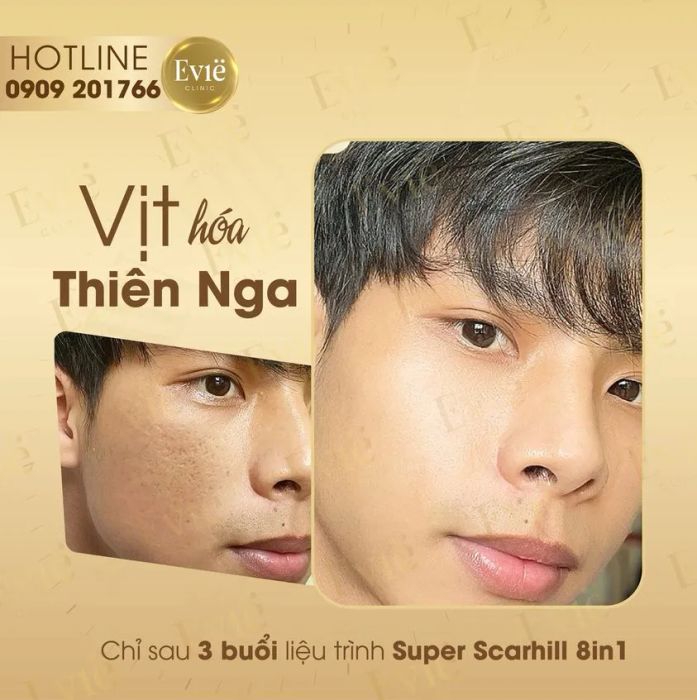 Hình ảnh thực tế về quy trình điều trị tại Evie Clinic