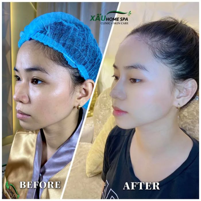 Trải nghiệm dịch vụ cao cấp tại Xấu Home Spa - nơi chăm sóc sắc đẹp toàn diện