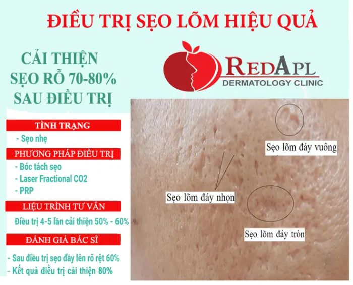 Hình ảnh thực tế Phòng Khám Da Liễu Táo Đỏ