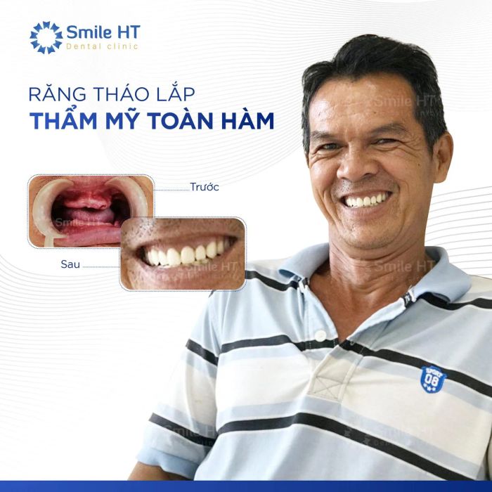 Nha Khoa Thẩm Mỹ Smile HT ảnh 1