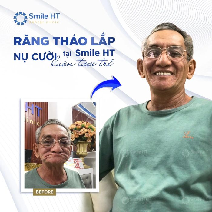Nha Khoa Thẩm Mỹ Smile HT ảnh 2