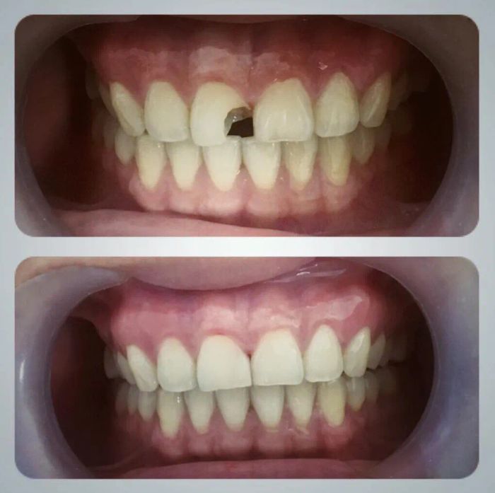 NHA KHOA GÒ MÂY ảnh 2