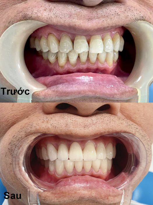 Ảnh minh họa Nha Khoa Bảo Ngọc - Hình 2
