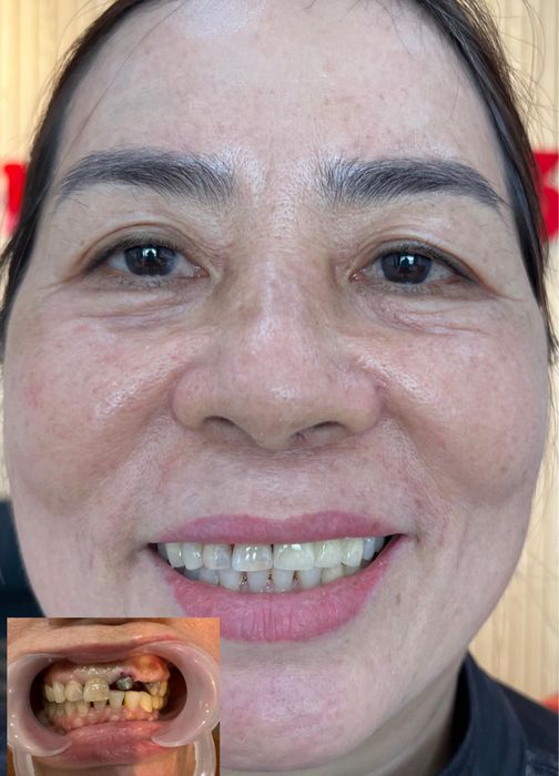 Ảnh minh họa Nha Khoa Minh Anh