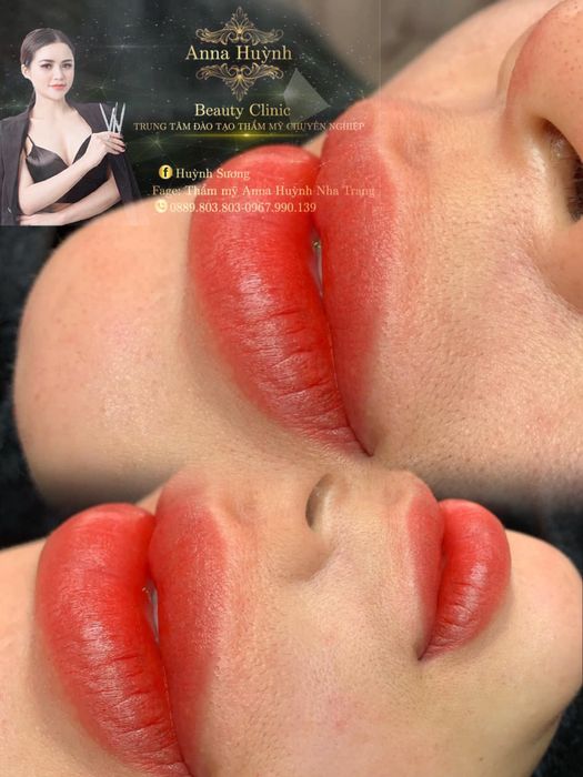 Anna Huỳnh Beauty Clinic & Academy - Hình ảnh 1