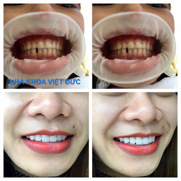 Nha khoa Việt Đức hình ảnh 2