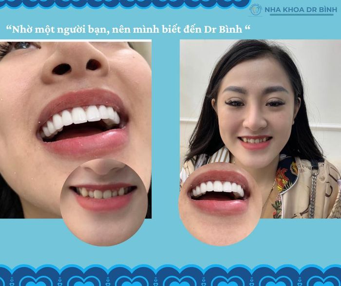 Nha Khoa Dr. Bình - hình ảnh 1