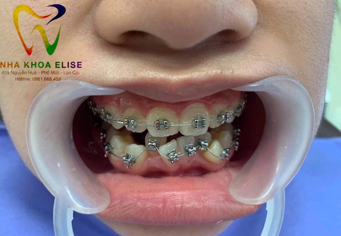 Hình ảnh thực tế về cơ sở vật chất hiện đại tại Nha khoa Elise
