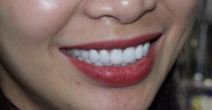 Hình ảnh không gian hiện đại và chuyên nghiệp tại Nha Khoa Trường Sơn