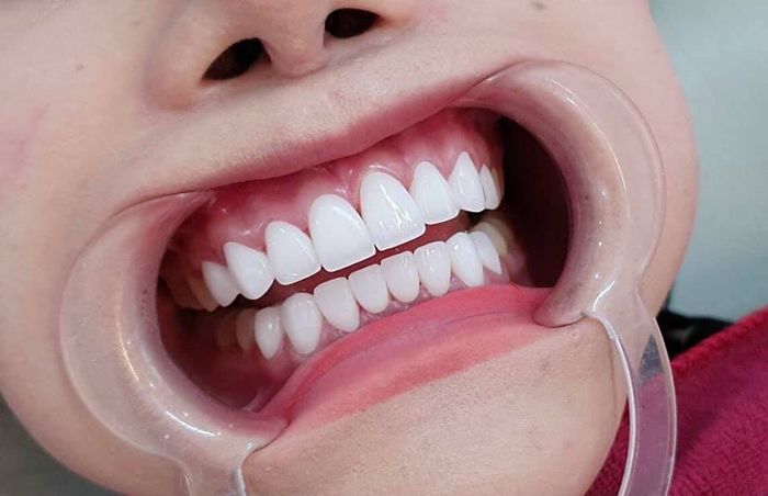 Không gian hiện đại và tiện nghi tại NHA KHOA VINH