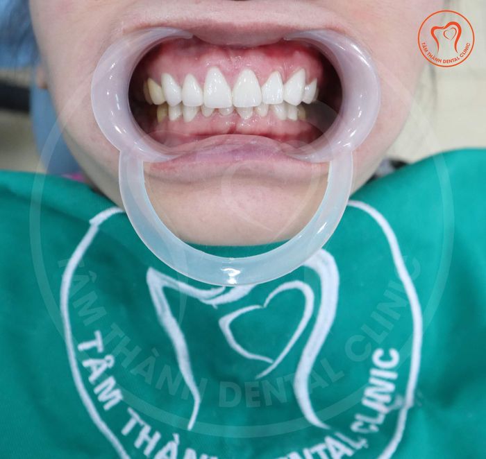Nha Khoa Tâm Thành Tuyên Quang hình ảnh 2