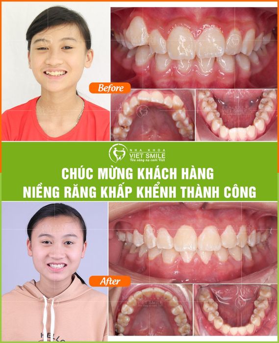 Hình ảnh đội ngũ bác sĩ chuyên môn cao tại Nha Khoa Viet Smile