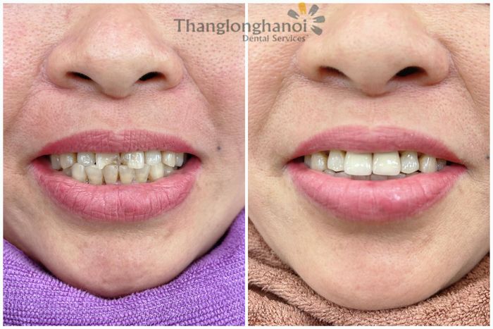 Không gian hiện đại tại Nha Khoa Thăng Long - Đông Anh