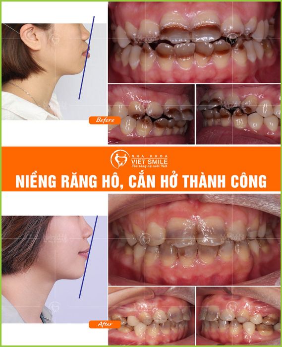Không gian hiện đại và sang trọng tại Nha Khoa Viet Smile Lào Cai