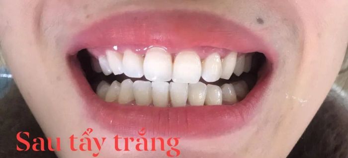 Nha Khoa Tâm Đức Từ Sơn hình ảnh 2