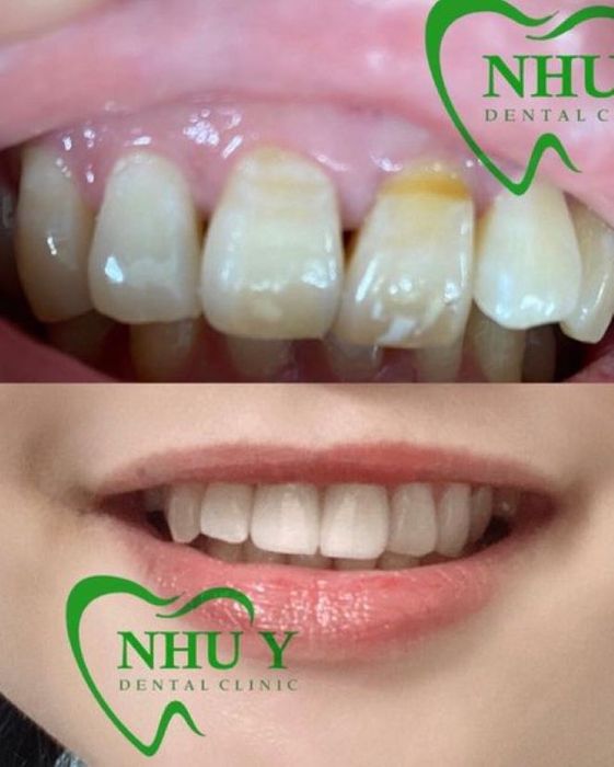 Nha Khoa Như Ý - hình ảnh 1