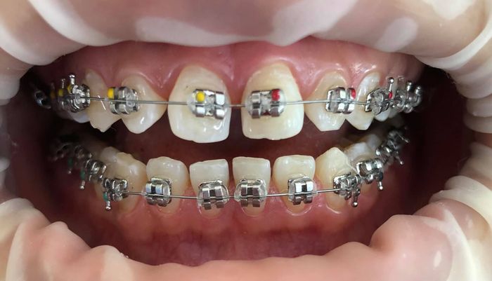 Đội ngũ bác sĩ chuyên môn cao và tận tâm tại Thiện Nhân Dental
