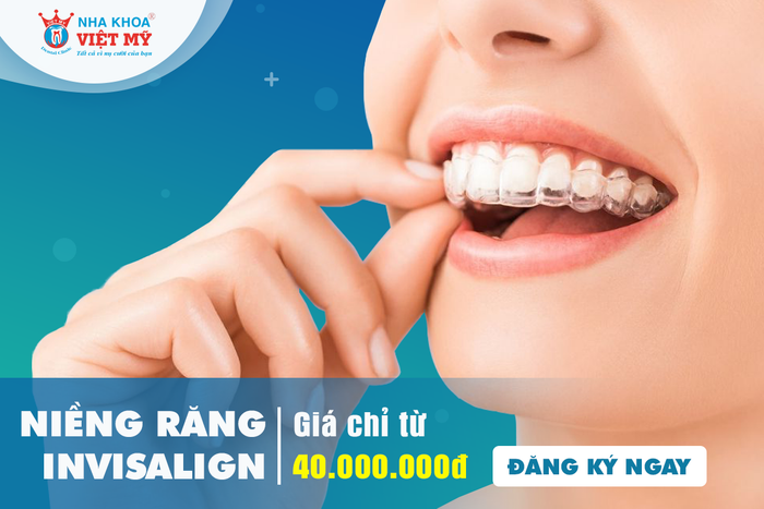 Quy trình niềng răng chuẩn quốc tế tại Nha Khoa Việt Mỹ - Bến Lức