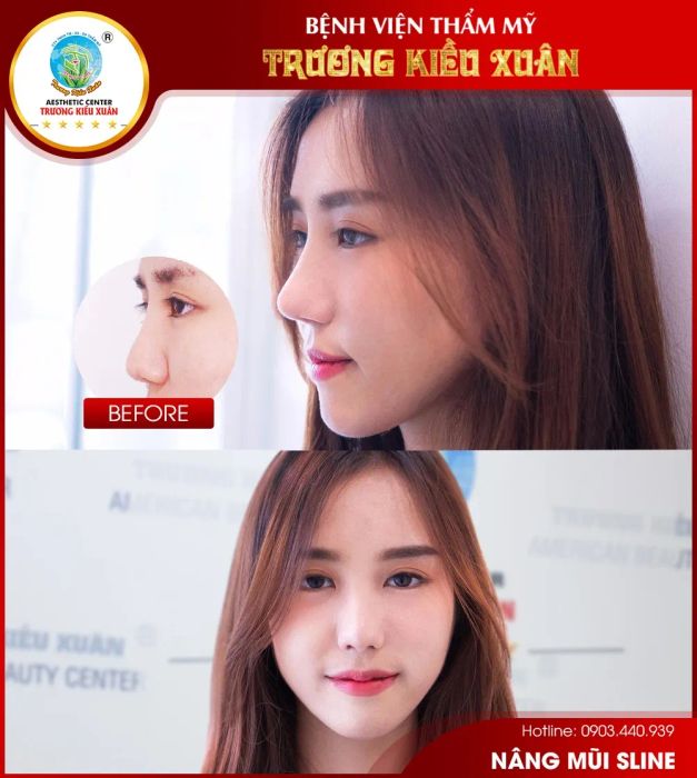 Hình ảnh Bệnh viện Thẩm mỹ Trương Kiều Xuân - Ảnh 2