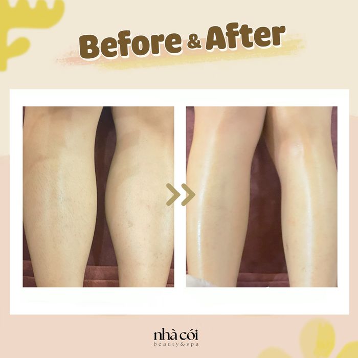 Hình ảnh dịch vụ wax lông chuyên nghiệp tại Nhà Cói Waxing