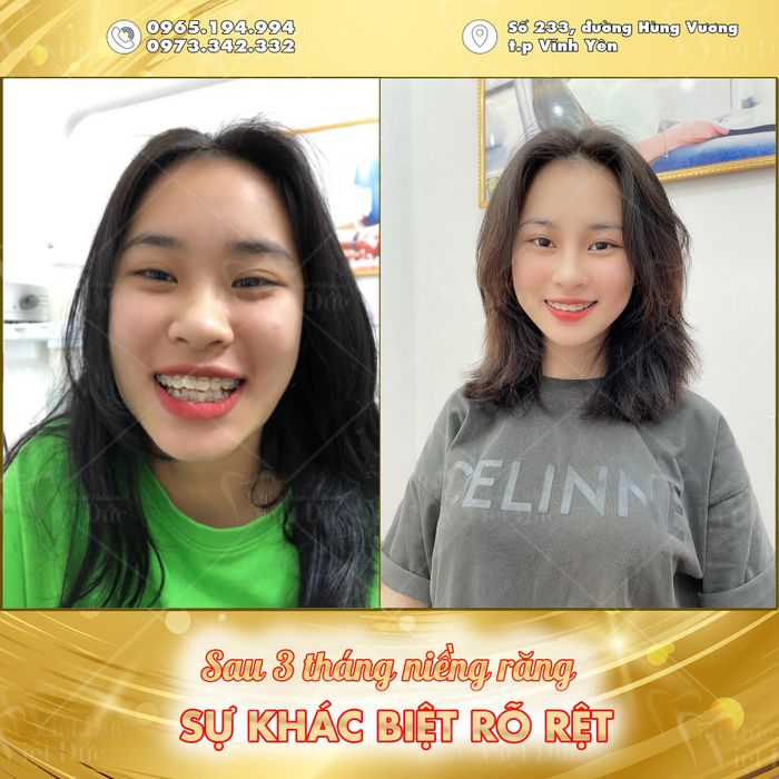 Nha Khoa Thẩm Mỹ Việt Đức ảnh 2